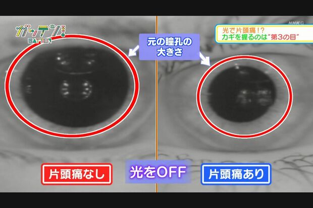 【光を消したあと】丸で囲んだ範囲が、光を当てる前の瞳孔の大きさ。片頭痛のある人は、光が消えても元の大きさまで戻っていない。（画像提供◎東海大学医学部 永田栄一郎さん、東海大学情報理工学部 高雄元晴さん）