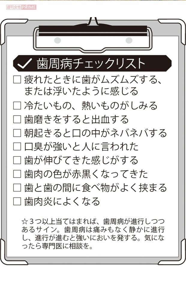 歯周病チェックリスト