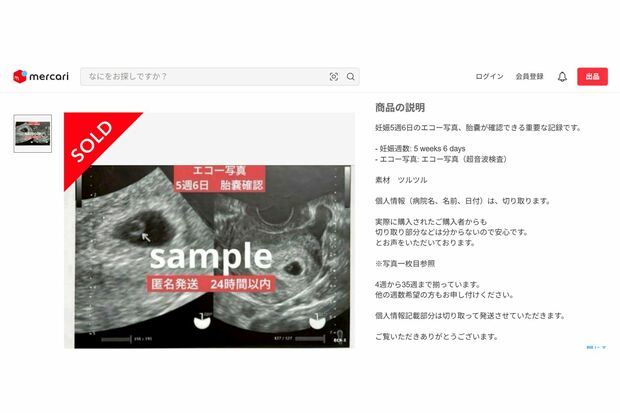 多様な週数で用意されているエコー写真も(メルカリより)