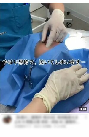 9歳の娘が二重整形する動画がSNSで炎上したケースも(本文登場の親子とは無関係です)