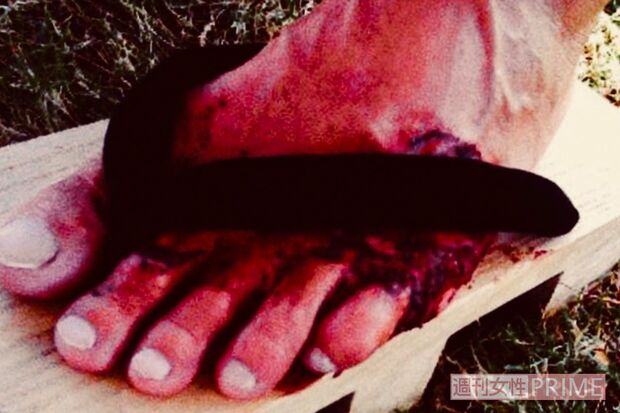 鼻緒に血で指が固まってしまい、激痛の中、完走後には氷水に足をつけて引き剥がしていたという。当然、水は血で真っ赤に