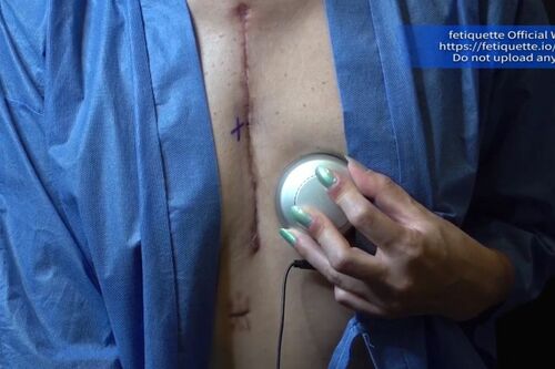 胸に聴診器をあてて心音を録音しているところ（会社のユーチューブより）