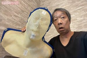 放射線治療に必要な、自身の型取りも行った。放射線をミリ単位で照射するため、この面で身体を固定する必要があるそう。「とんねるずの『生ダラ』でやっていた特殊メイクを思い出しました（笑）」