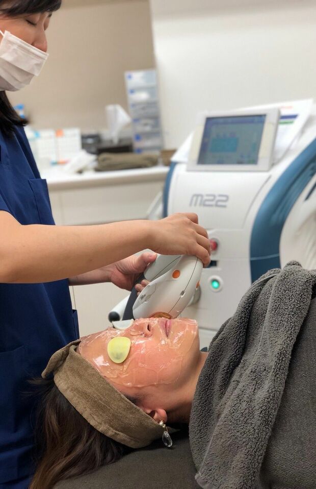 「IPLフォトフェイシャル」を顔全体にまんべんなく照射