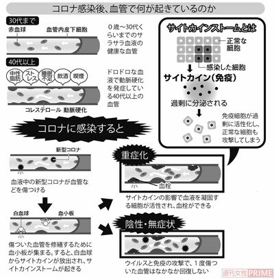 コロナ感染後、血管で何が起きているのか