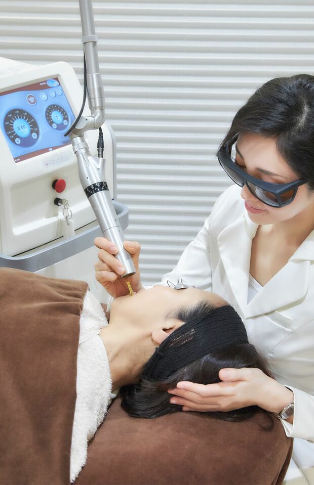 最新シミ取り施術「ピコレーザー」