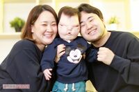 世界でも前例なし難病“おもちくん”の両親、おでこの骨やまぶたがない状態で生まれても「存在に感謝」
