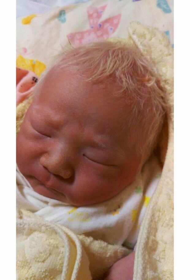 生まれたときにはすでに白髪だった