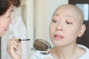 想定はしていた抗がん剤による脱毛。「家族が笑い飛ばしてくれたから、私も笑って乗り越えられました」と財目かおりさん