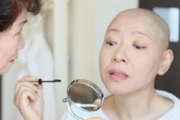 想定はしていた抗がん剤による脱毛。「家族が笑い飛ばしてくれたから、私も笑って乗り越えられました」と財目かおりさん