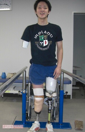 事故から約3か月、初めて義足をつけて感動の涙を流した　写真提供／山田千紘さん