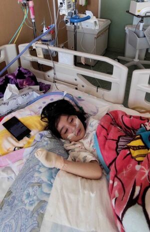 右胸の管から栄養の点滴を入れ、腸の管から排液を外に出しており、常につながれている状態(写真は本人提供)