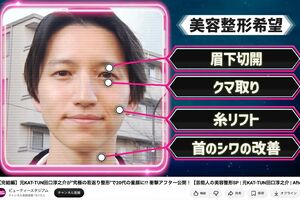 YouTube番組『ビューティースタジアム』で若返り整形に挑戦した田口淳之介