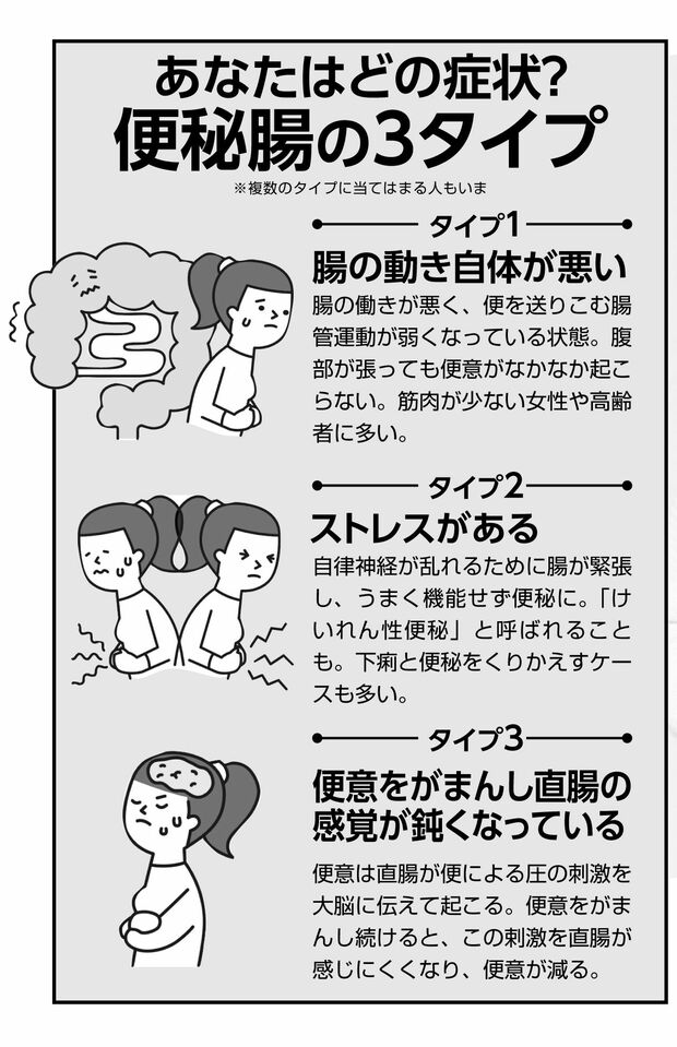 あなたは便秘のどのタイプ？